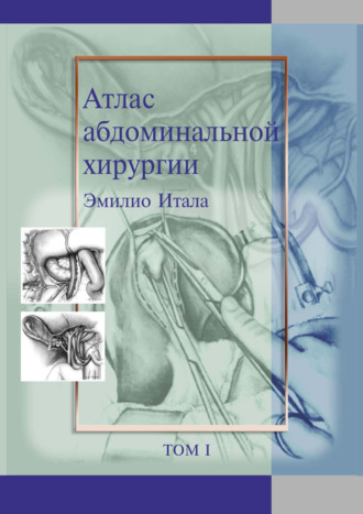 Эмилио Итала. Атлас абдоминальной хирургии. Том 1. Хирургия печени, желчных путей, поджелудочной железы и портальной системы