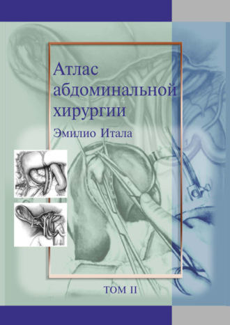 Эмилио Итала. Атлас абдоминальной хирургии. Том 2. Хирургия желудка и двенадцатиперстной кишки