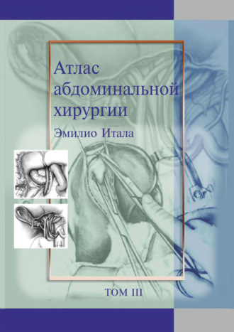 Эмилио Итала. Атлас абдоминальной хирургии. Том 3. Хирургия тонкой и толстой кишки, прямой кишки и анальной области