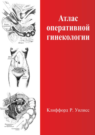 Клиффорд Р. Уилисс. Атлас оперативной гинекологии