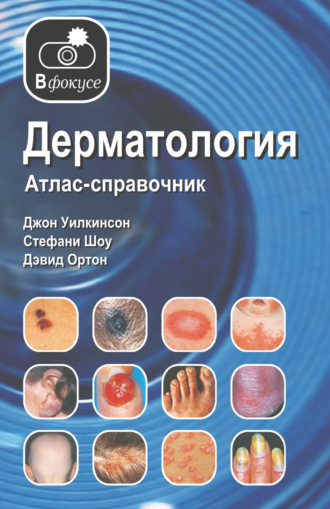 Джон Уилкинсон. Дерматология. Атлас – справочник