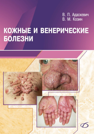 Владимир Адаскевич. Кожные и венерические болезни
