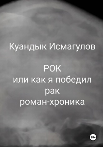 Куандык Исмагулов. Рок, или Как я победил рак