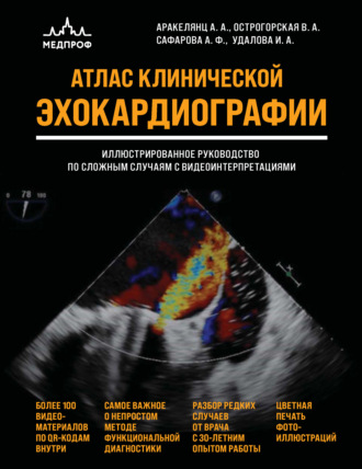 А. А. Аракелянц. Атлас ЭхоКГ. Иллюстрированное руководство по сложным случаям с видеоинтерпретациями