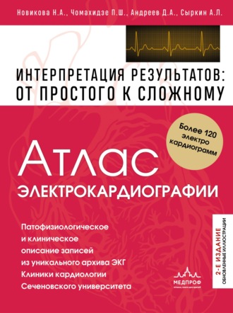 Петр Чомахидзе. Атлас электрокардиографии. Интерпретация результатов: от простого к сложному. 2-е издание